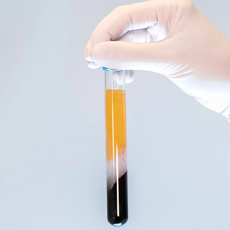 PRP – Plasma riche en plaquettes PRP – Plasma riche en plaquettes